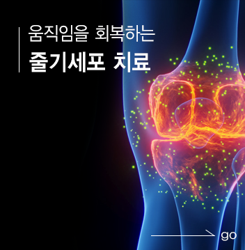줄기세포 치료